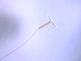 Copper Intrauterine Device (IUD). Visit whatsnextforme.ca/choices for more information.